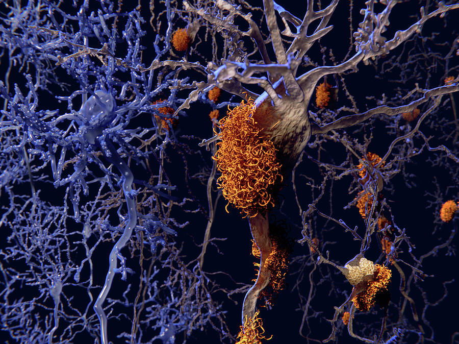 Brain Nerve Cells Affected By Alzheimers #1 Photograph by Juan Gaertner