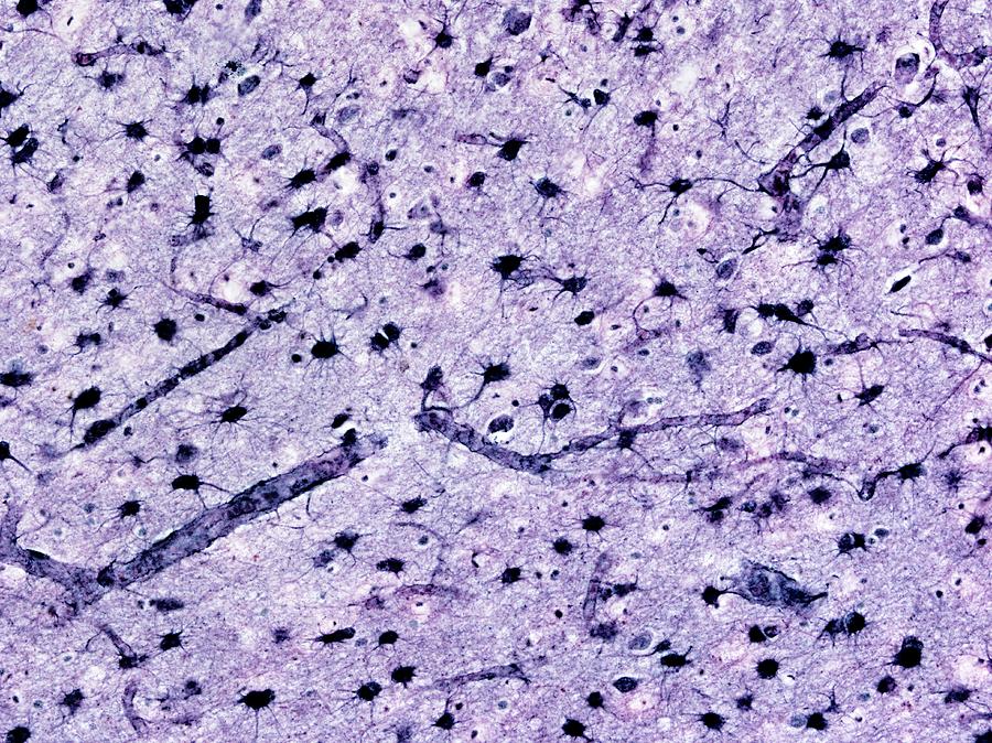Brain Tissue #1 Photograph by Microscape