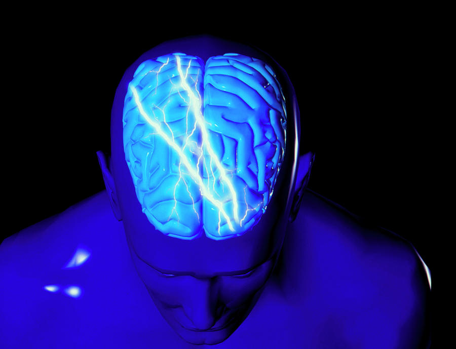 Brain With Lightning Bolts: Headache Or Epilepsy by Alfred Pasieka/science  Photo Library