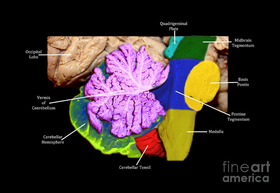 Human Photograph - Brainstem, Cerebellum And Occipital Lobe #1 by Living Art Enterprises