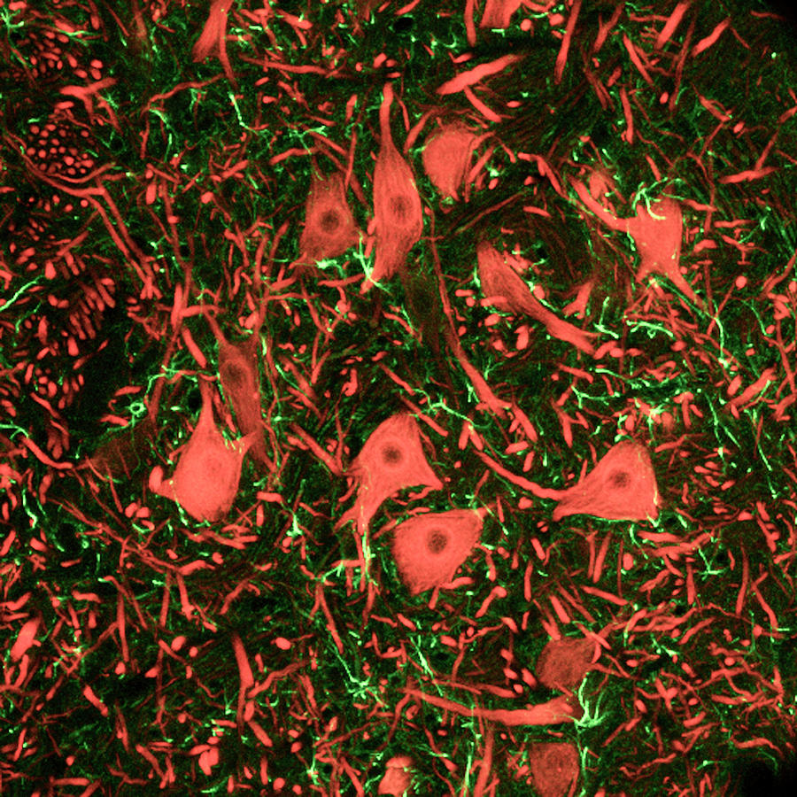 Brainstem Nerve Cells #1 Photograph by C.j.guerin, Phd, Mrc Toxicology Unit/ Science Photo Library