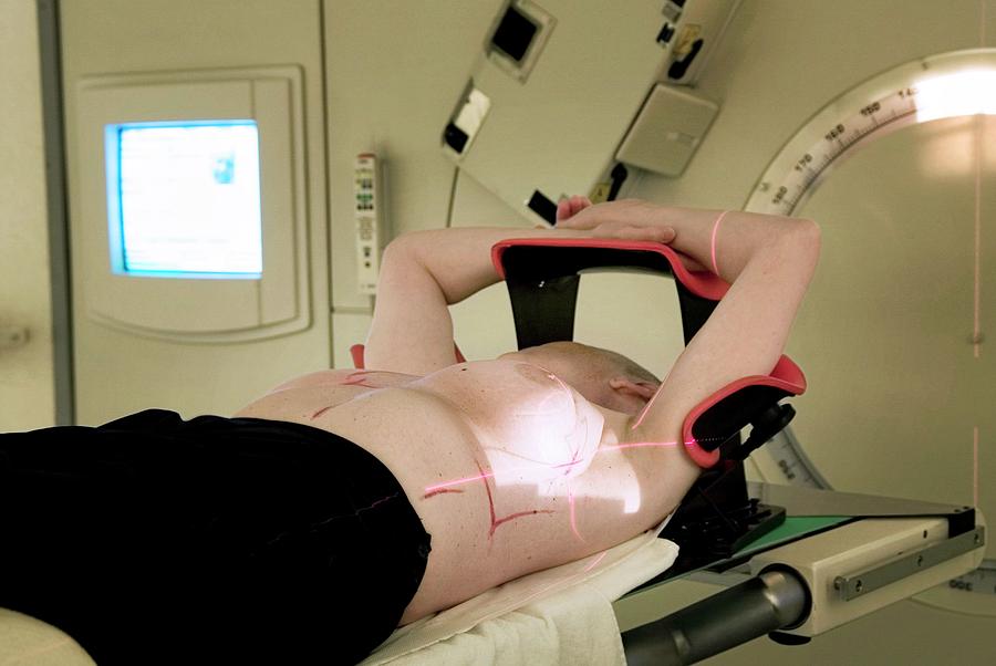 Breast Cancer Radiotherapy #1 Photograph by Camille Van Vooren/reporters/science Photo Library