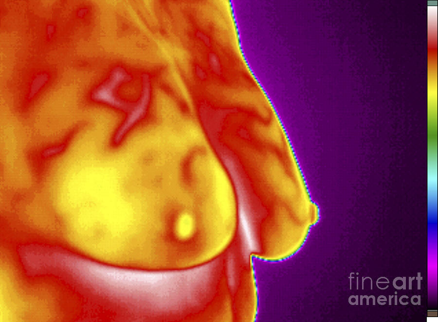 Breast Thermography #1 Photograph by GIPhotoStock