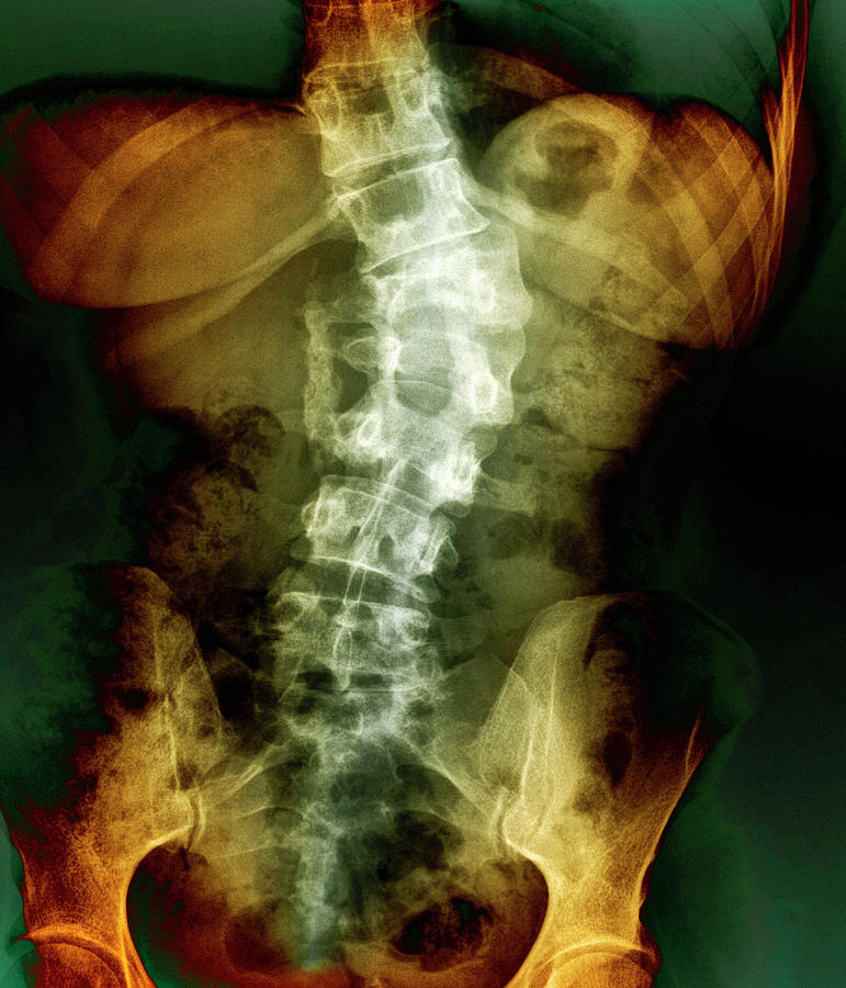 broken-back-photograph-by-zephyr-science-photo-library-pixels