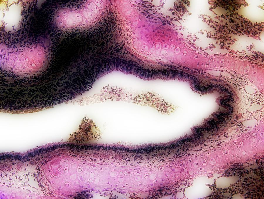 Tissue Photograph - Bronchus In Lung Tissue #1 by John Griffin, University Of Queensland/science Photo Library