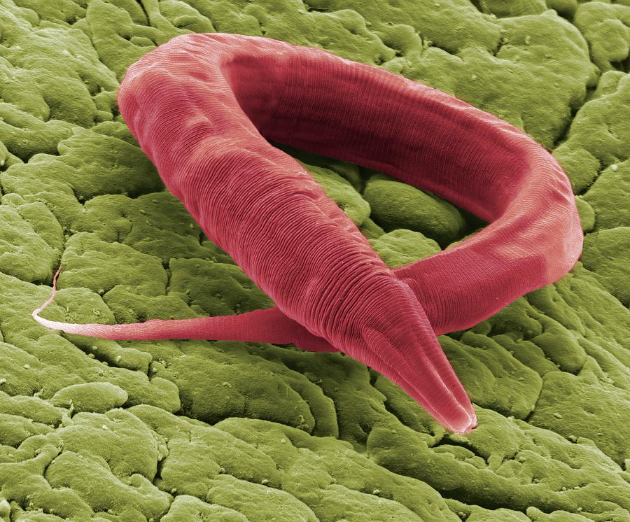 C. Elegans Worm #1 Photograph by Steve Gschmeissner