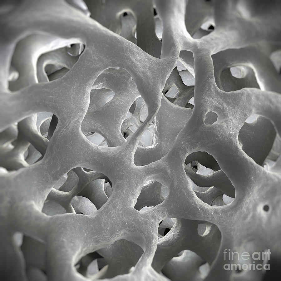 Cancellous Bone #1 Photograph by Science Picture Co