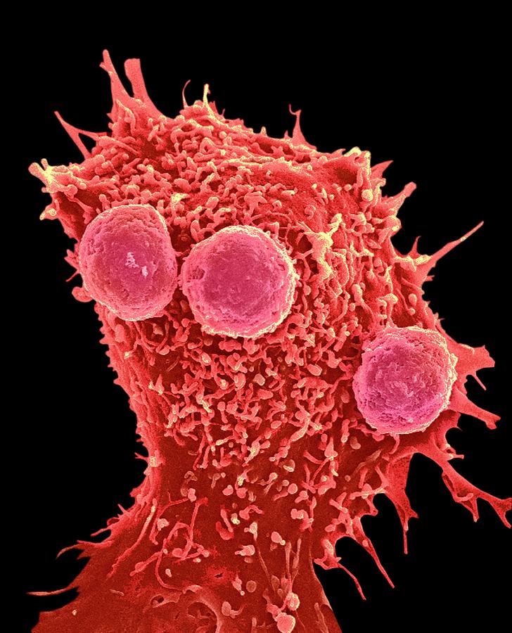 Cancer Cell And T Lymphocytes #1 Photograph by Steve Gschmeissner