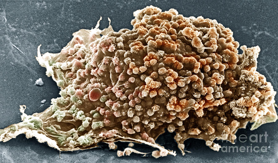 Cancer Cell #1 Photograph by David M. Phillips