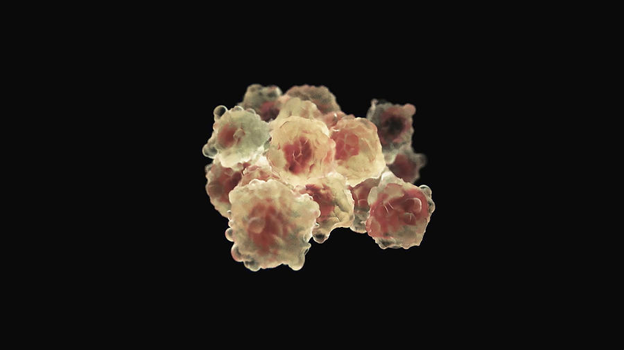 Cancer Cells Dividing #1 Photograph by Anatomical Travelogue