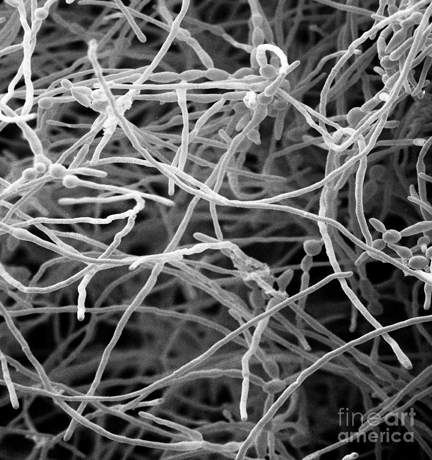 Candida #1 Photograph by David M. Phillips