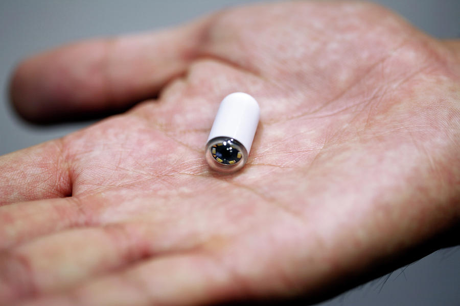 capsule-endoscopy-uses-side-effects-and-results