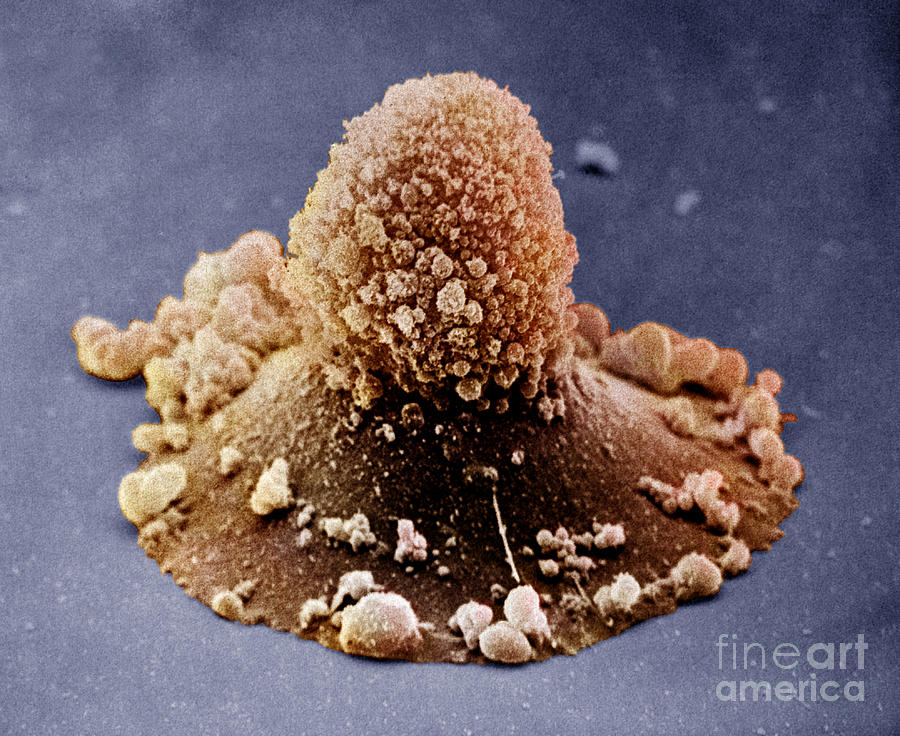 Carcinoma Cell Apoptosis #1 Photograph by David M. Phillips