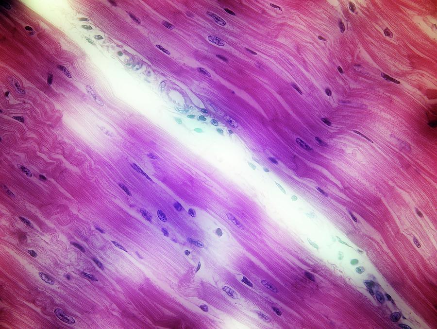 Cardiac Muscle #1 Photograph by John Griffin, University Of Queensland/science Photo Library