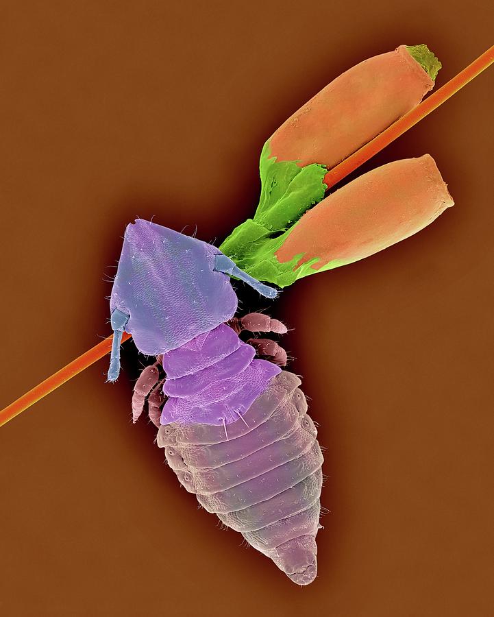 Cat Biting Louse And Egg Cases Photograph by Dennis Kunkel Microscopy