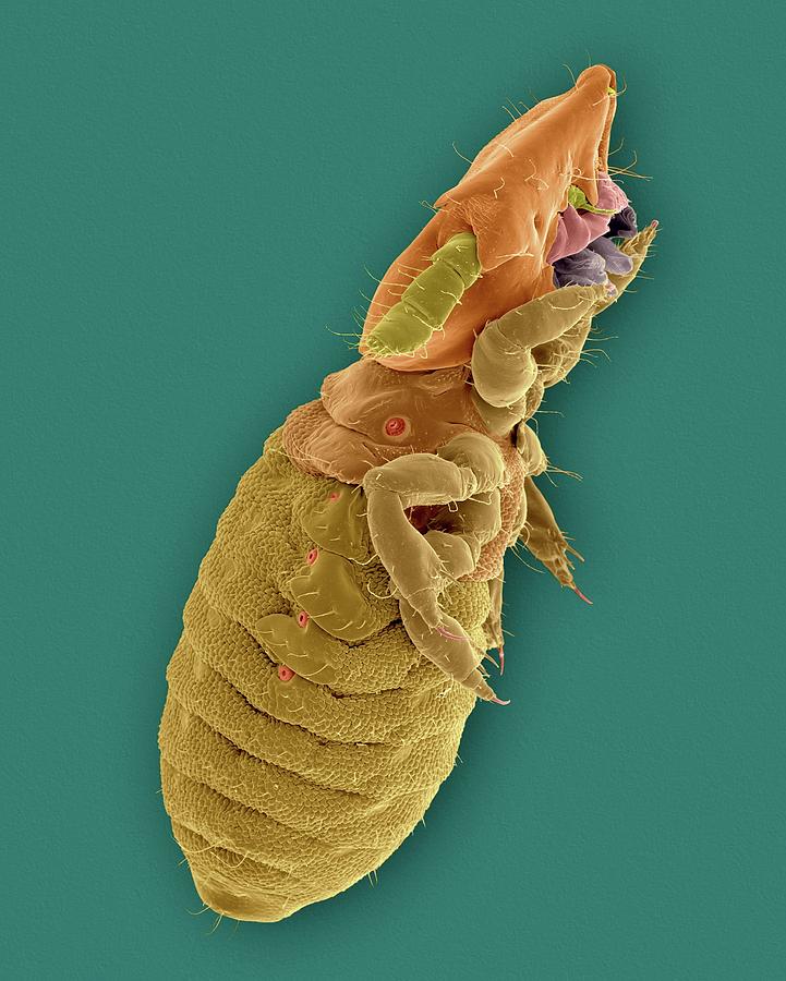 Cat Biting Louse Photograph by Dennis Kunkel Microscopy/science Photo