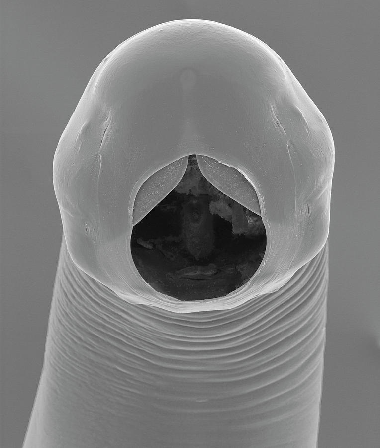 Cattle Hookworm Bunostomum Phlebotomum Photograph By Dennis Kunkel Microscopyscience Photo 