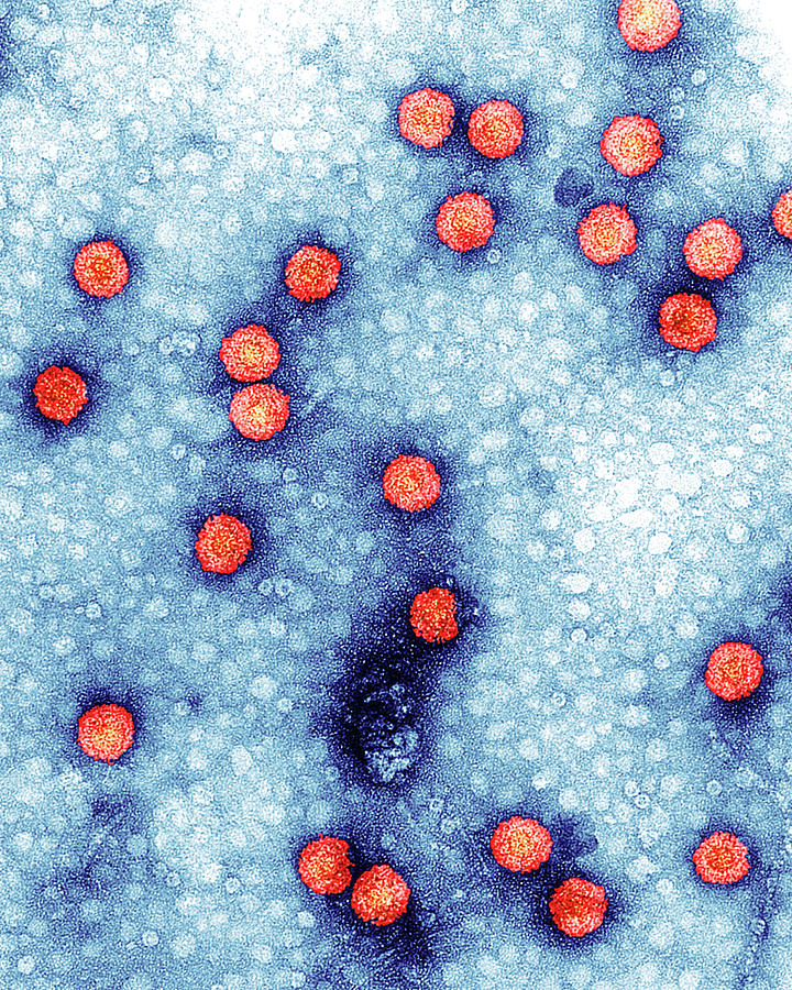 Cauliflower Mosaic Virus #1 Photograph by Science Photo Library Cauliflower Mosaic Virus #1 Photograph by Science Photo Library
