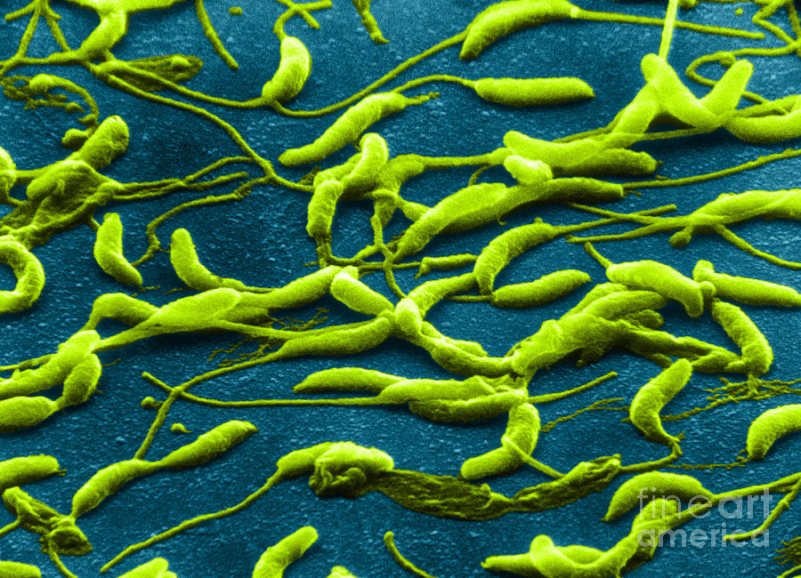 Caulobacter Crescentus, Sem #1 Photograph by Biology Pics
