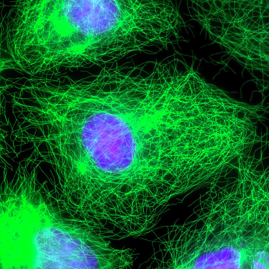 Cell Division Photograph by Dr Torsten Wittmann