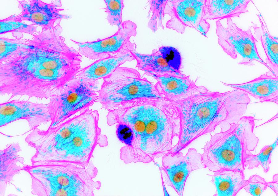Cells Stained For Proteins #1 Photograph by Kevin Mackenzie / University Of Aberdeen / Science Photo Library