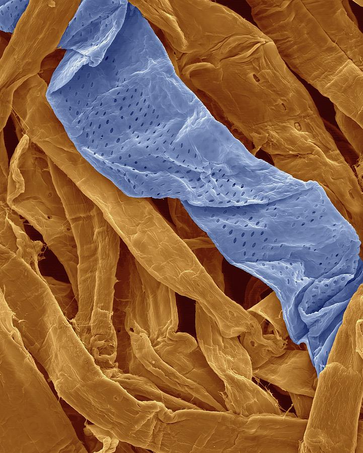 Cellulose Fibres In Toilet Paper #1 Photograph by Dennis Kunkel Microscopy/science Photo Library