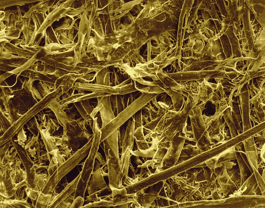 Cellulose Fibres (paper Towel) #1 Photograph by Dennis Kunkel Microscopy/science Photo Library