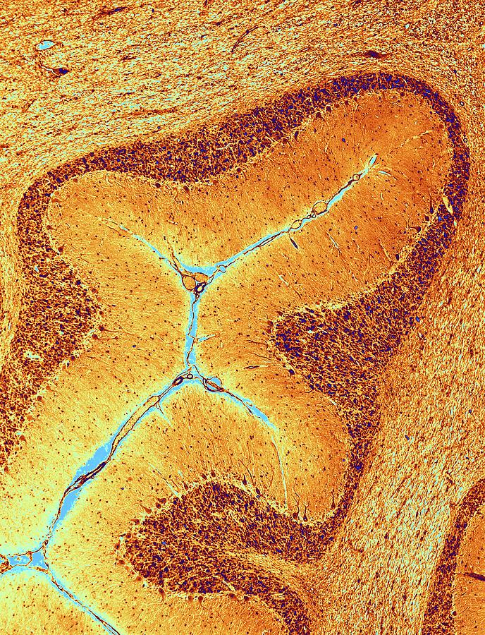 Cerebellum Tissue #1 Photograph by Alfred Pasieka/science Photo Library