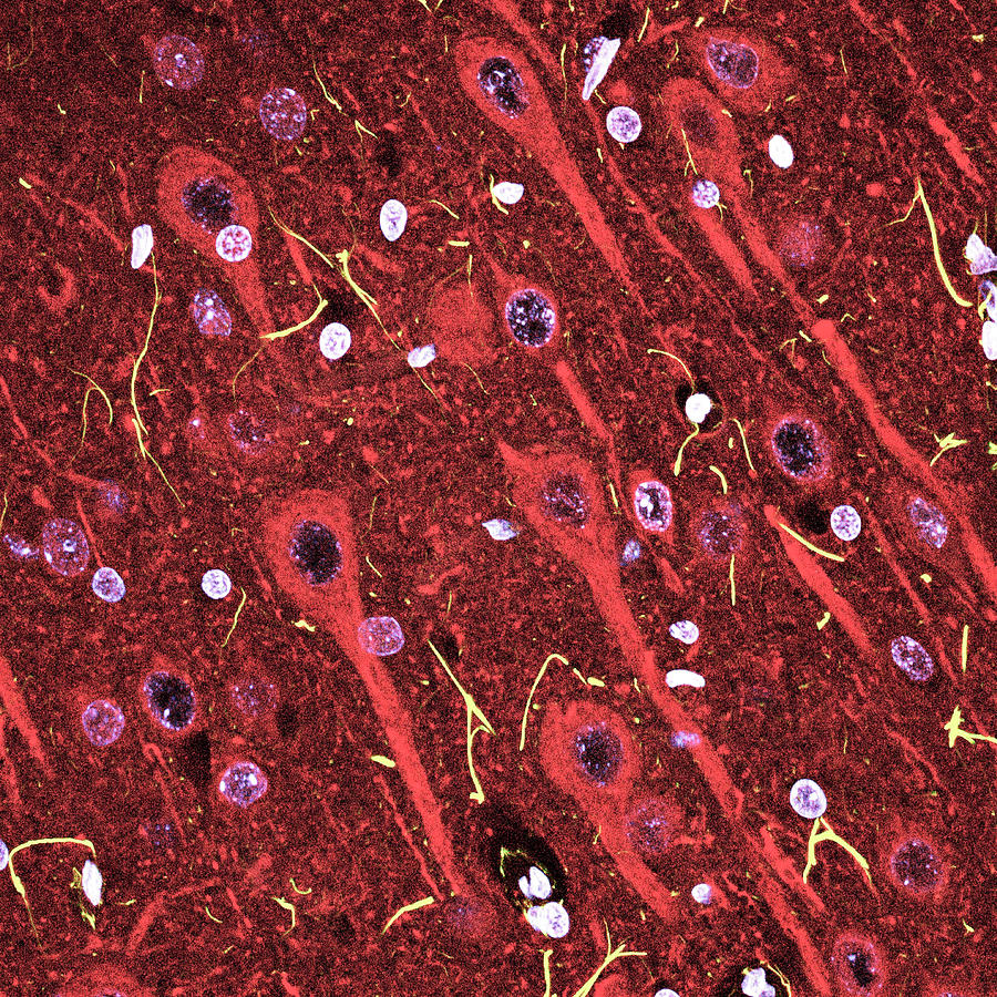Cerebral Cortex Nerve Cells #1 Photograph by C.j.guerin, Phd, Mrc Toxicology Unit/ Science Photo Library