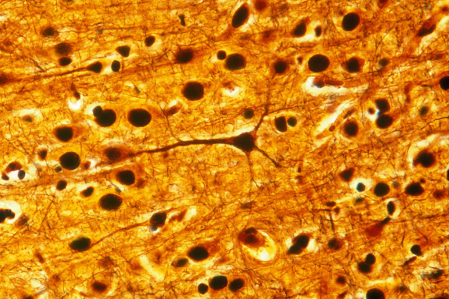 Cerebral Cortex Pyramidal Cells, Lm #1 Photograph by Michael Abbey
