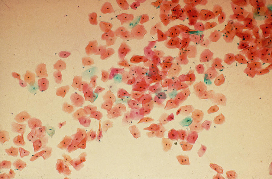Cervical Smear Mid-cycle #1 Photograph by Science Photo Library.