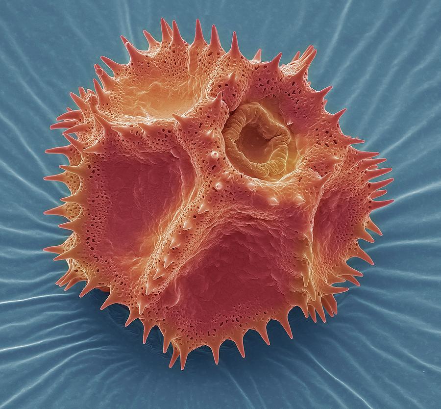 Chicory Pollen Grain #1 Photograph by Steve Gschmeissner