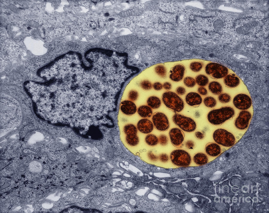 Chlamydia Infection, Tem #1 Photograph by David M. Phillips