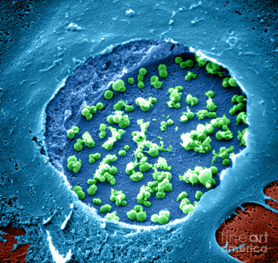 Bacteria Photograph - Chlamydia, Sem #1 by David M. Phillips