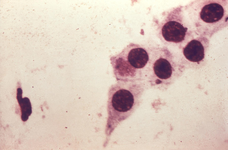 Chlamydia Trachomatis Bacteria, Lm #1 Photograph by Science Source