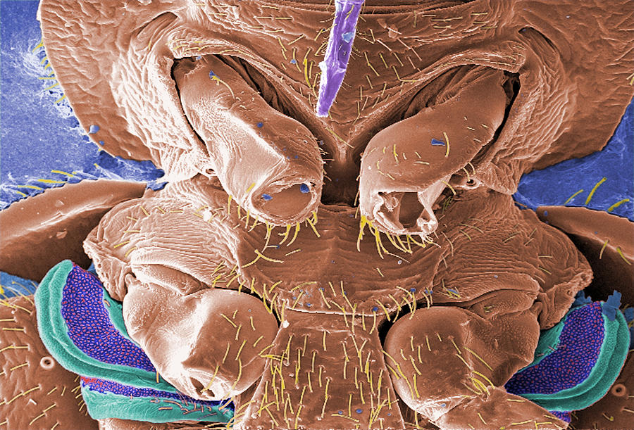 Cimex Lectularius, Bed Bug, Sem #1 Photograph by Science Source