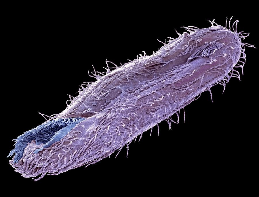 Climacostomum Protozoan Photograph by Steve Gschmeissner - Fine Art America