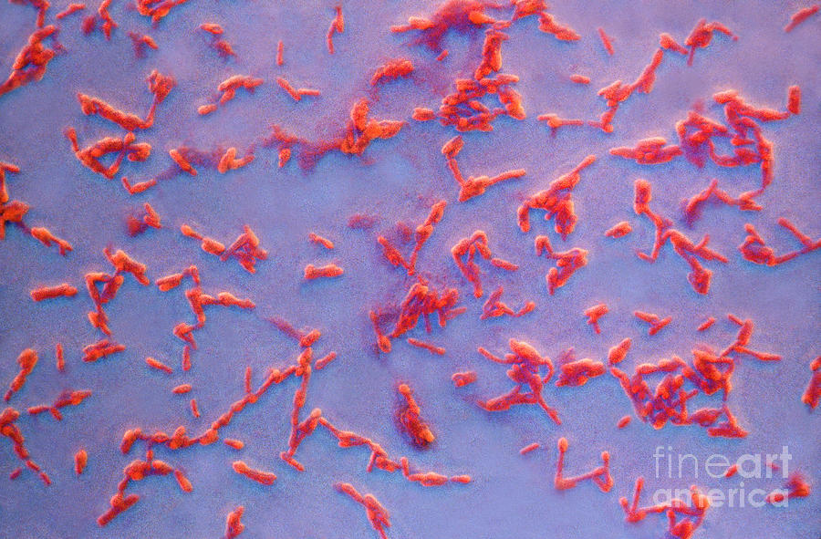 Bacterium Photograph - Clostridium Botulinum #1 by Kent Wood