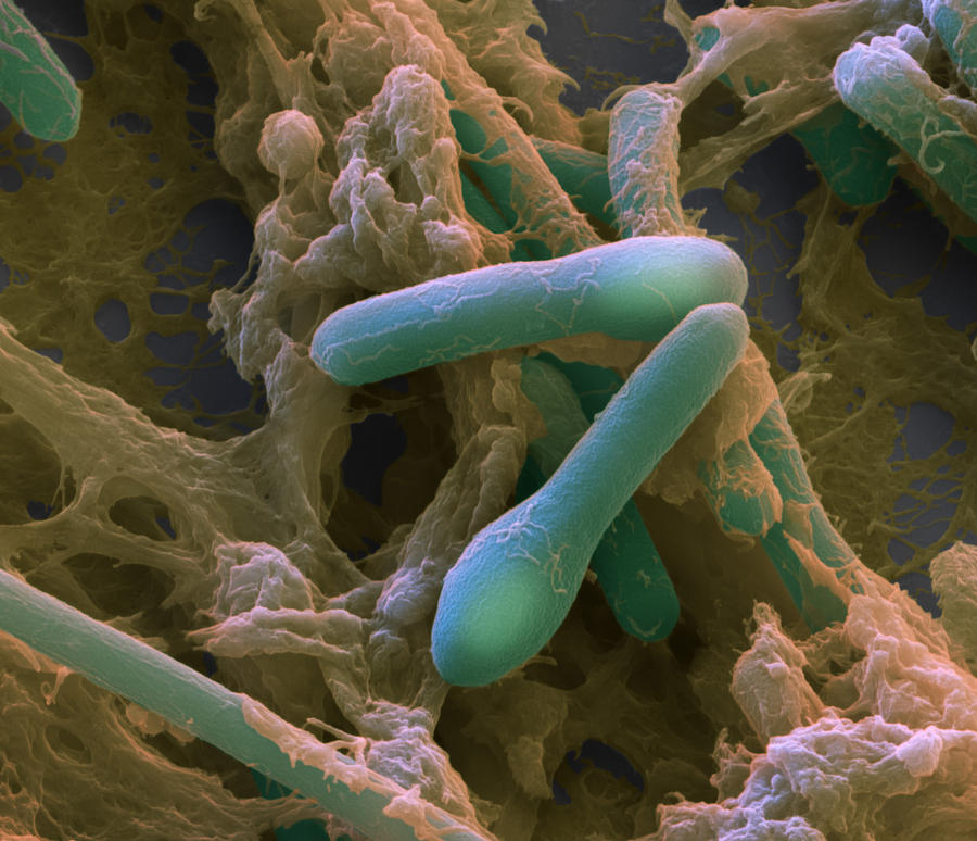 Clostridium Botulinum, Sem #1 Photograph by Eye of Science