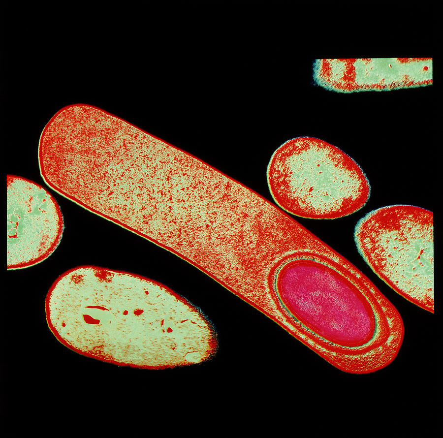 Кластридии. Бактерии клостридиум. Clostridium difficile под микроскопом. Клостридия ботулизма бактерия.