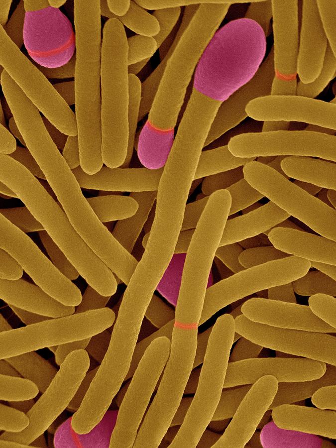 Clostridium Phytofermentans Photograph By Dennis Kunkel Microscopy Science Photo Library Pixels