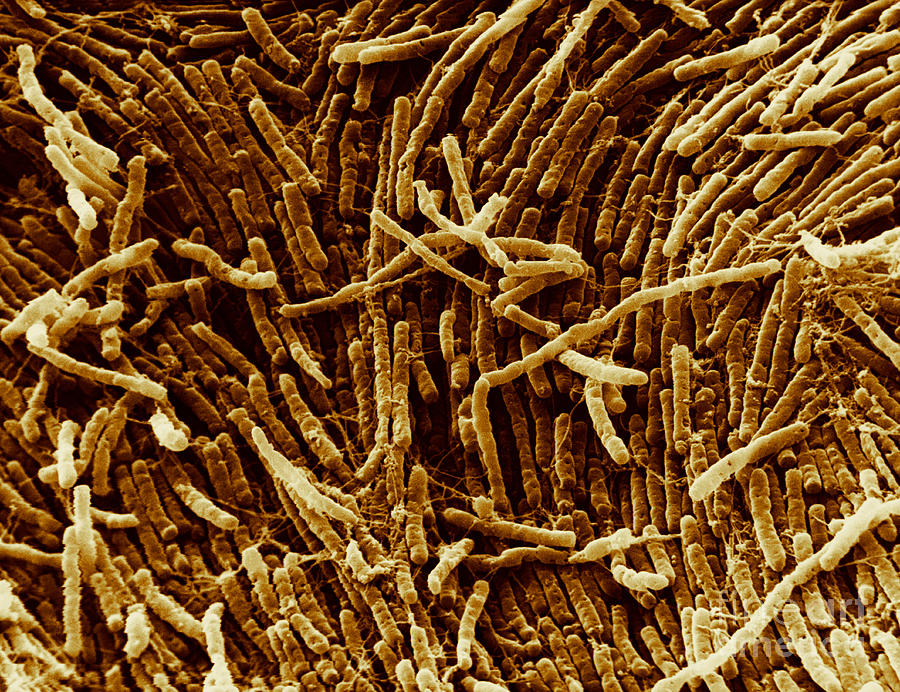 Sem Photograph - Clostridium, Sem #1 by David M. Phillips