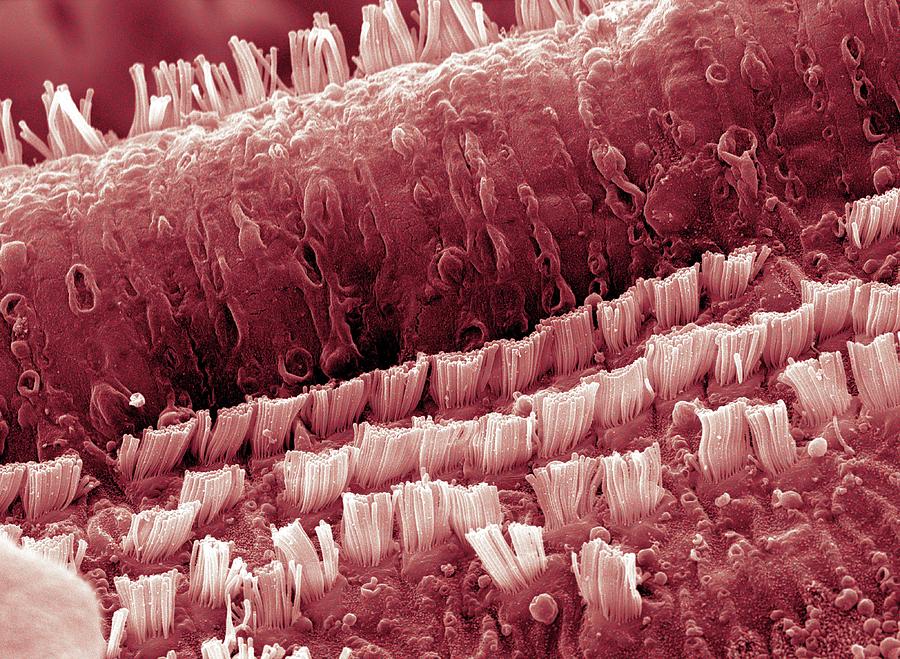 Cochlea Cells #1 Photograph by Clouds Hill Imaging Ltd/science Photo Library