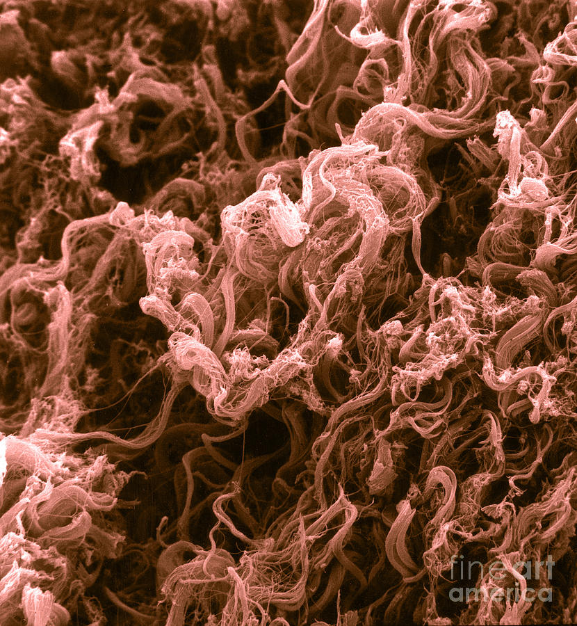 Collagen Fibers, Sem #1 Photograph by David M. Phillips