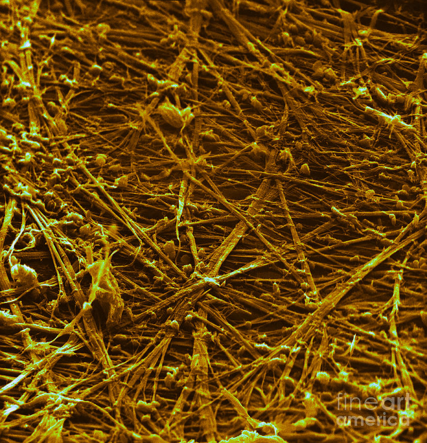 Collagen, Sem #1 Photograph by David M. Phillips - Pixels