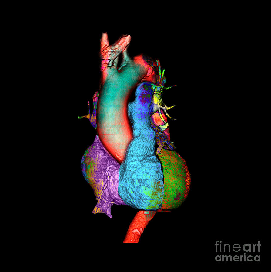 Color Enhanced 3d Ct Of Heart #1 Photograph by Living Art Enterprises