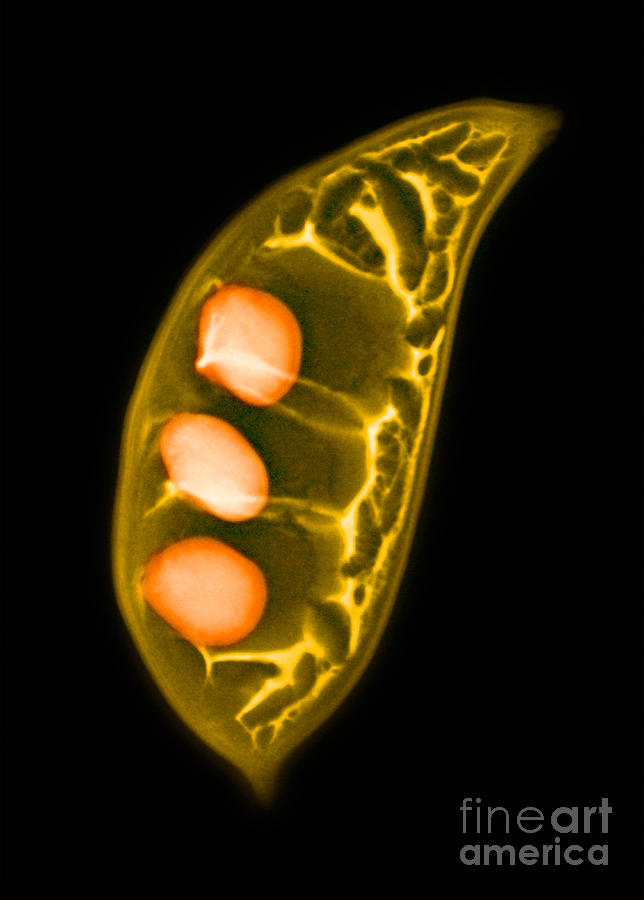 Colorized X-ray Of Seed Pods #1 Photograph by Scott Camazine
