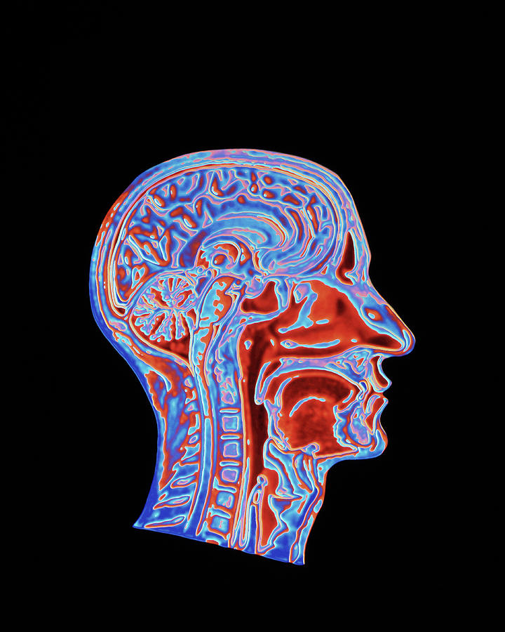 Coloured Ct Scan Of A Head Showing A Healthy Brain Photograph by Pasieka