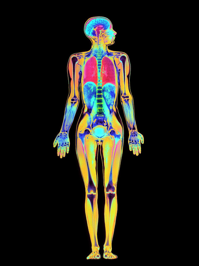 Coloured Mri Scan Of A Whole Human Body (female) #1 Photograph by Simon Fraser/science Photo Library