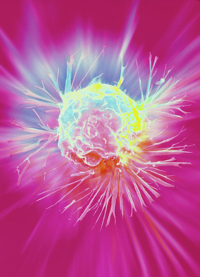 Images Photograph - Coloured Sem Of A Breast Cancer Cell #1 by Nci/science Photo Library
